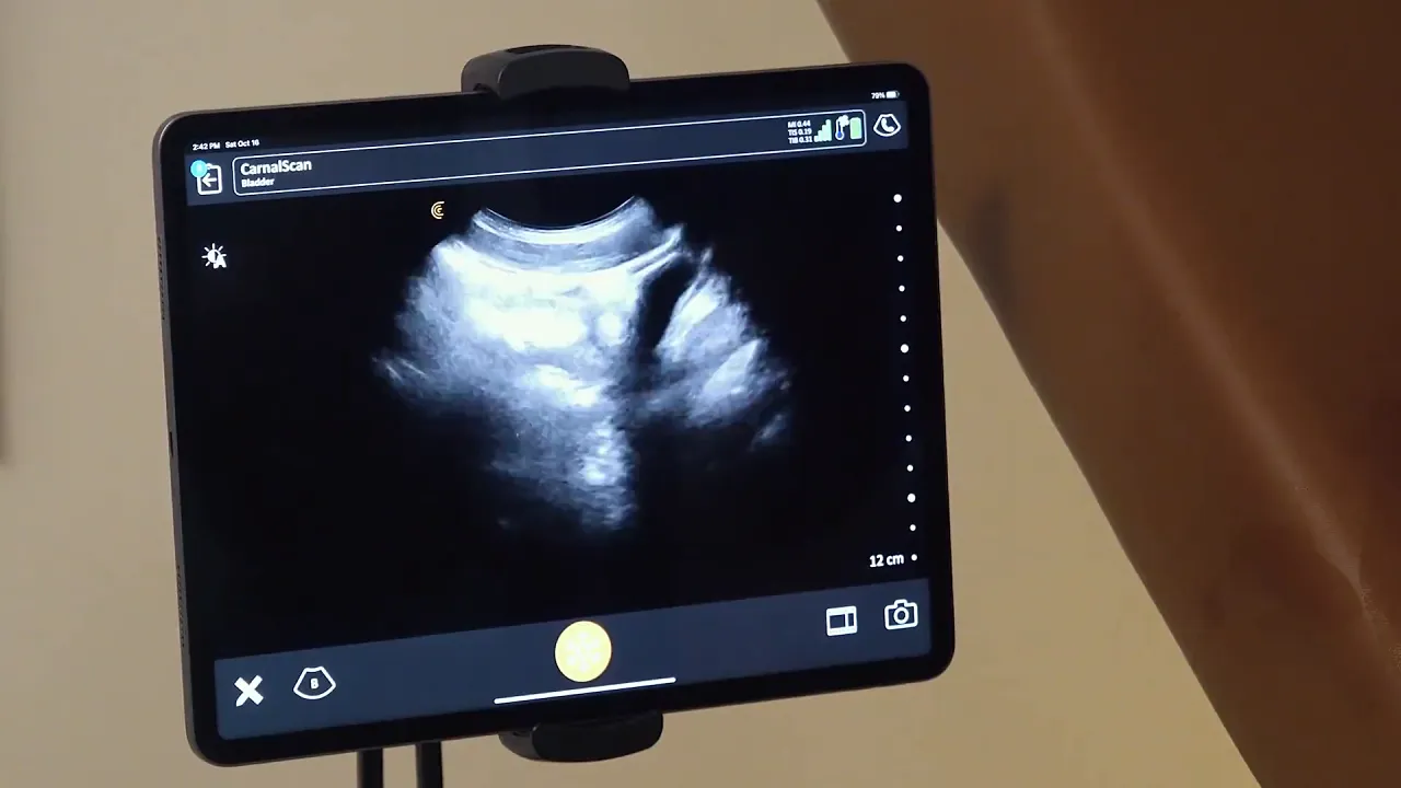 Muscular gay doctor uses big cock to breed tiny ultrasound hole in Legrand Wolf's bottom